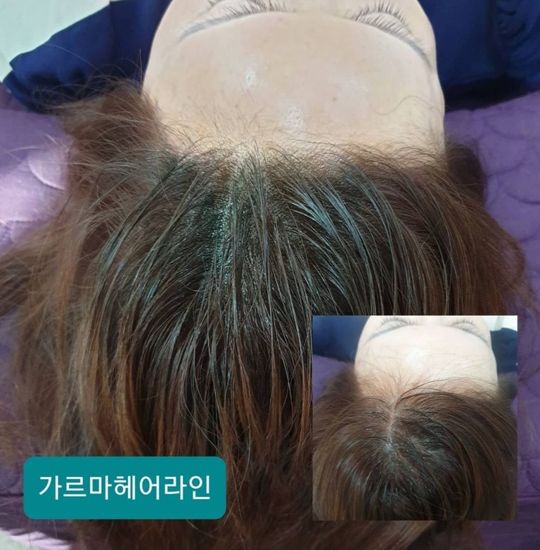 가르마 헤어라인